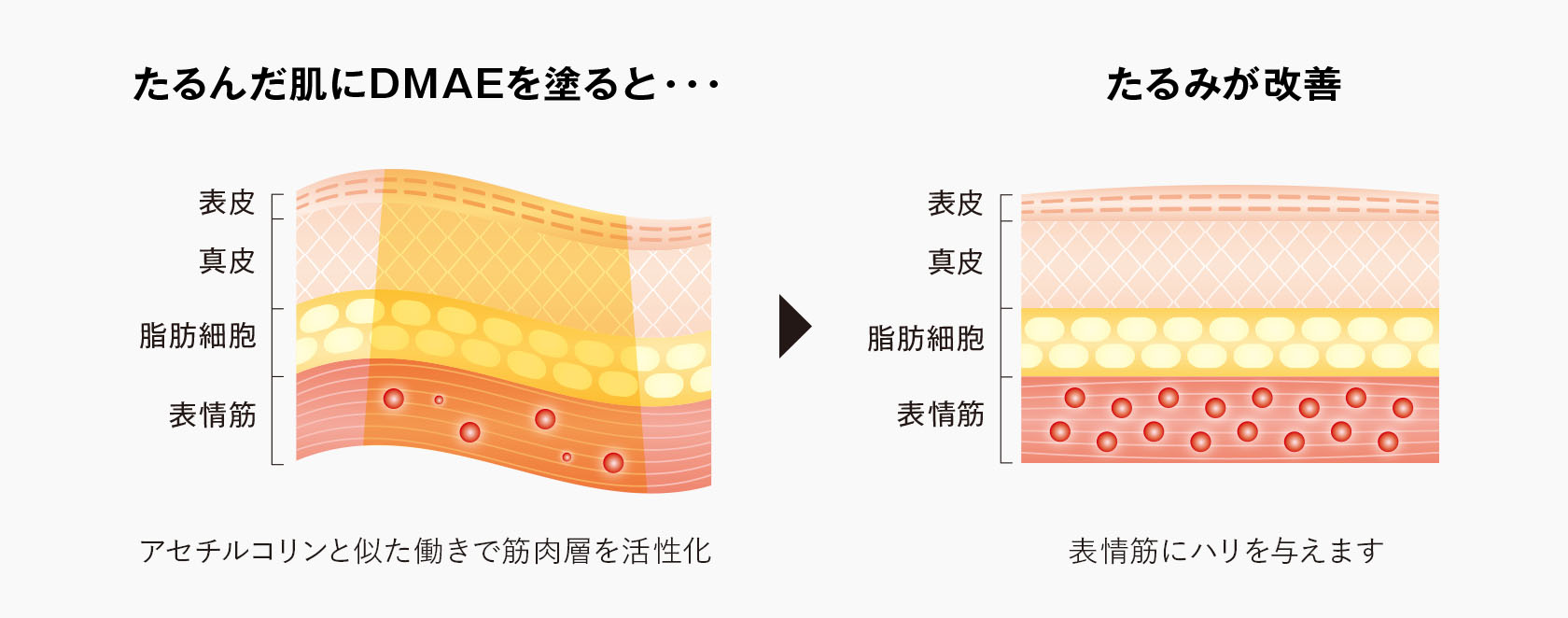 ファンデの改善イメージ